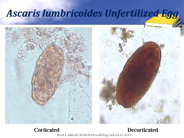 Ascaris lumbricoides Unfertilized Egg Corticated Decorticated Raed Z. Ahmed, Medical Parasitology Lab. , 2012