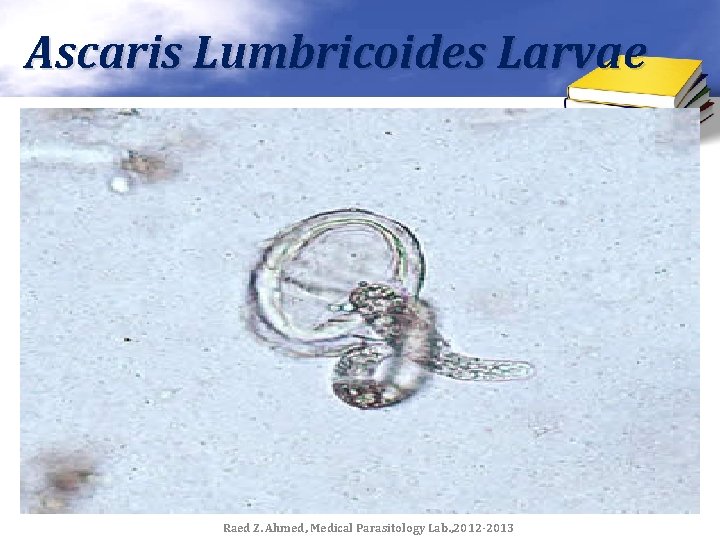 Ascaris Lumbricoides Larvae Raed Z. Ahmed, Medical Parasitology Lab. , 2012 -2013 