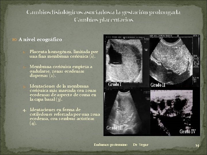 Cambios fisiológicos asociados a la gestación prolongada Cambios placentarios A nivel ecográfico 1. Placenta