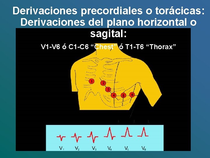 Derivaciones precordiales o torácicas: Derivaciones del plano horizontal o sagital: V 1 -V 6