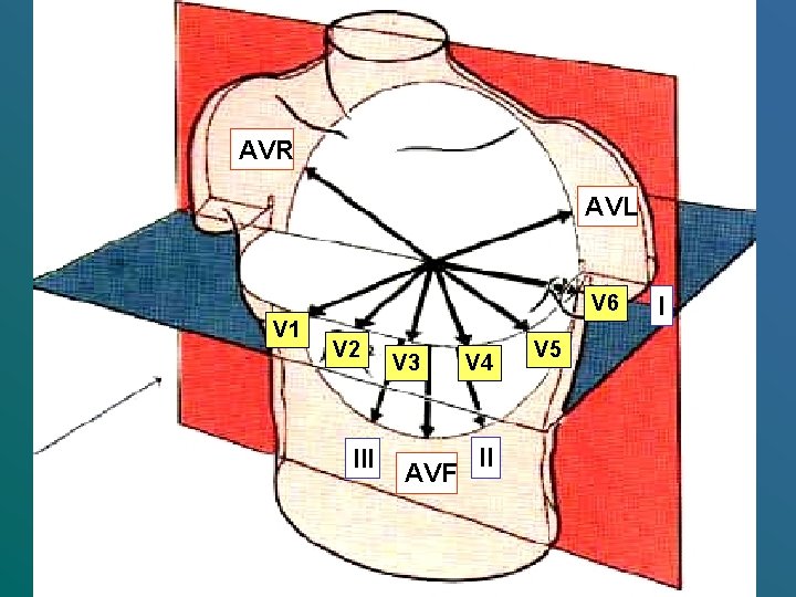 AVR AVL V 6 V 1 V 2 III V 3 AVF V 4