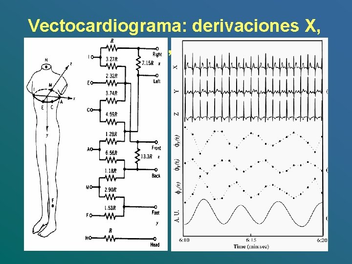 Vectocardiograma: derivaciones X, Y, Z. 
