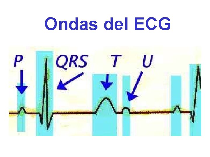 Ondas del ECG 