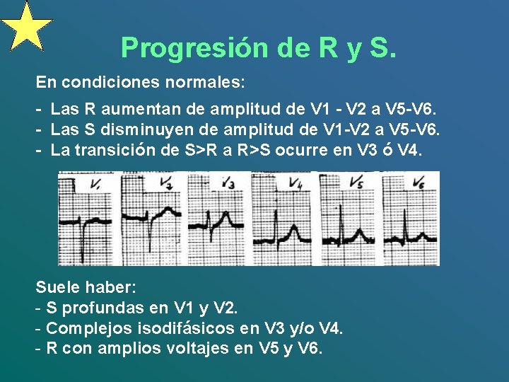 Progresión de R y S. En condiciones normales: - Las R aumentan de amplitud