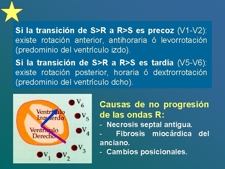 Si la transición de S>R a R>S es precoz (V 1 -V 2): existe