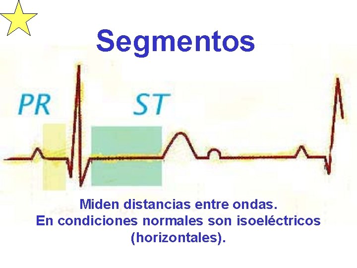 Segmentos Miden distancias entre ondas. En condiciones normales son isoeléctricos (horizontales). 