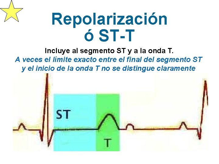 Repolarización ó ST-T Incluye al segmento ST y a la onda T. A veces