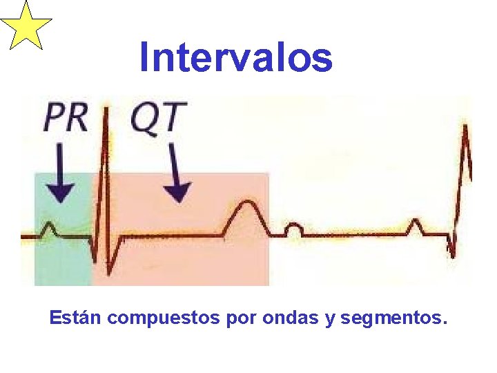 Intervalos Están compuestos por ondas y segmentos. 