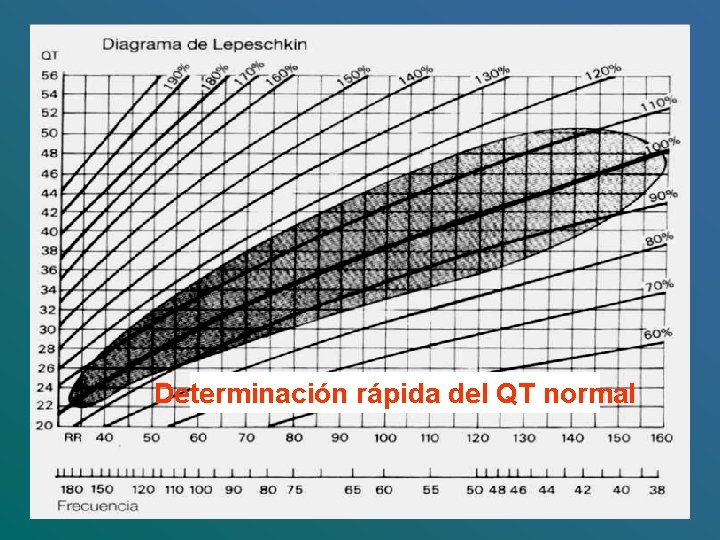 Determinación rápida del QT normal 