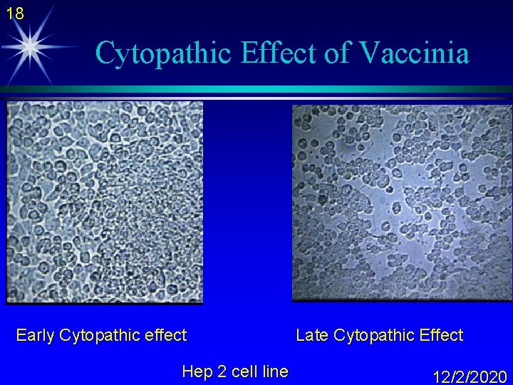 18 Cytopathic Effect of Vaccinia Early Cytopathic effect Hep 2 cell line Late Cytopathic