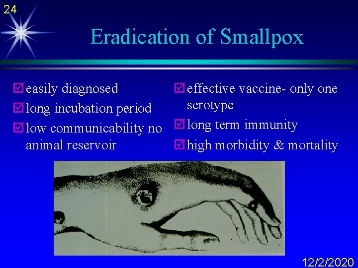 24 Eradication of Smallpox þ easily diagnosed þ effective vaccine- only one serotype þ