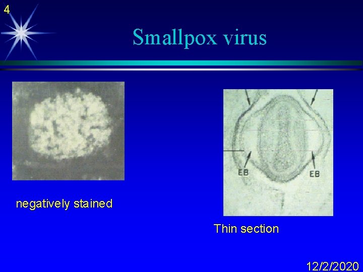 4 Smallpox virus negatively stained Thin section 12/2/2020 