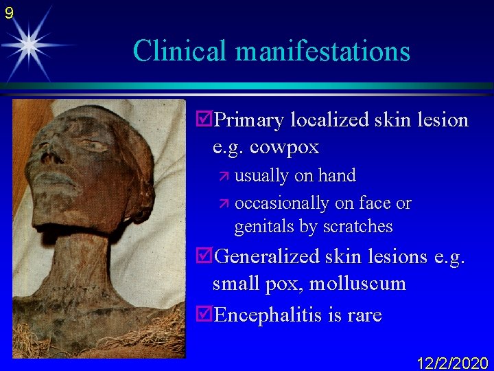 9 Clinical manifestations þPrimary localized skin lesion e. g. cowpox ä usually on hand