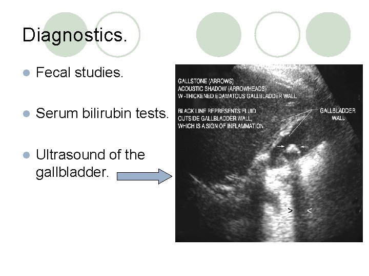 Diagnostics. l Fecal studies. l Serum bilirubin tests. l Ultrasound of the gallbladder. 