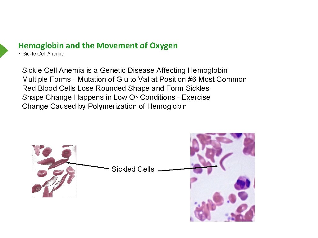 Hemoglobin and the Movement of Oxygen • Sickle Cell Anemia is a Genetic Disease