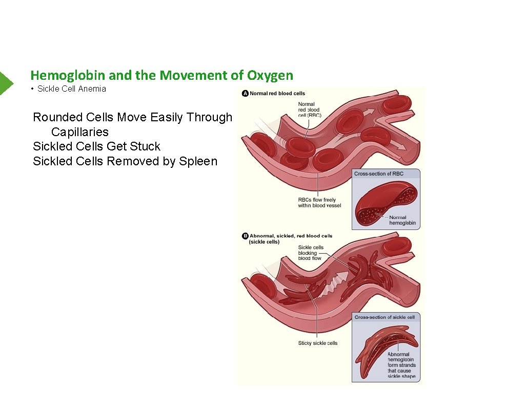 Hemoglobin and the Movement of Oxygen • Sickle Cell Anemia Rounded Cells Move Easily