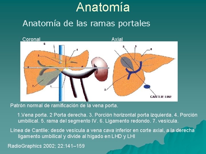 Anatomía de las ramas portales Coronal Axial Patrón normal de ramificación de la vena