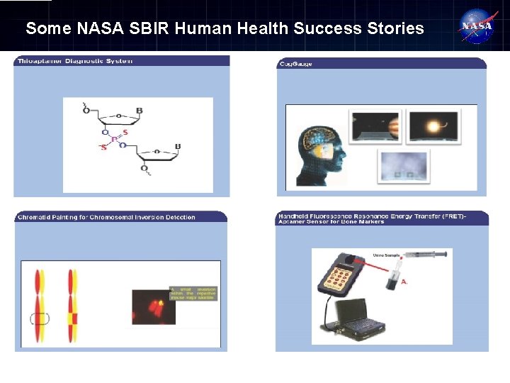 Some NASA SBIR Human Health Success Stories 