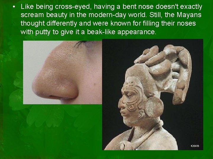  • Like being cross-eyed, having a bent nose doesn't exactly scream beauty in