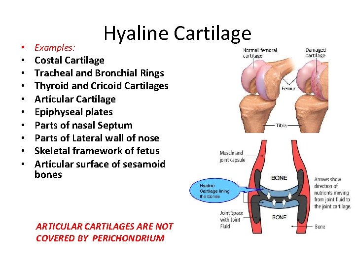 • Examples: • • • Hyaline Cartilage Costal Cartilage Tracheal and Bronchial Rings • Examples: • • • Hyaline Cartilage Costal Cartilage Tracheal and Bronchial Rings