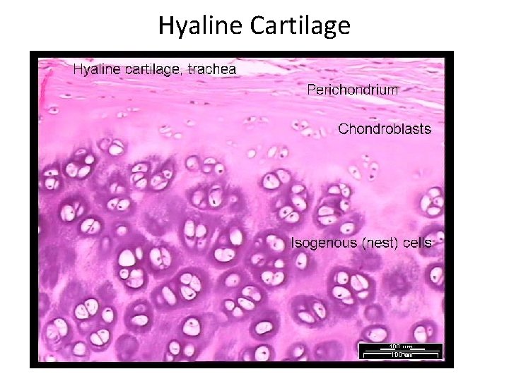 Hyaline Cartilage Hyaline Cartilage