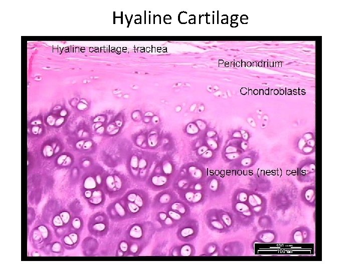 Hyaline Cartilage 