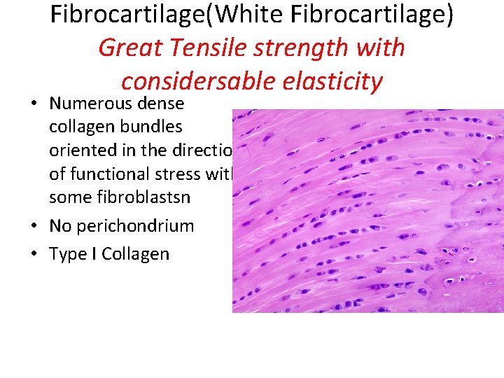 Fibrocartilage(White Fibrocartilage) Great Tensile strength with considersable elasticity • Numerous dense collagen bundles oriented