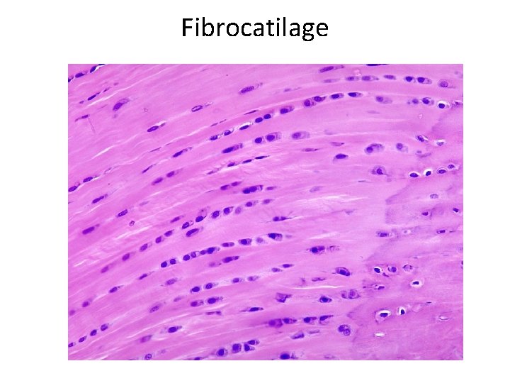 Fibrocatilage 