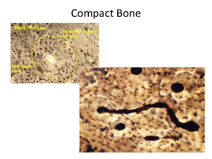 Compact Bone 