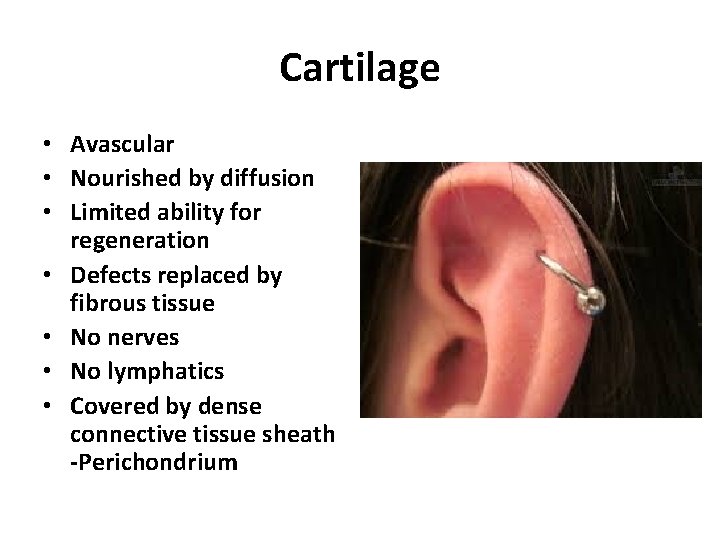 Cartilage • Avascular • Nourished by diffusion • Limited ability for regeneration • Defects