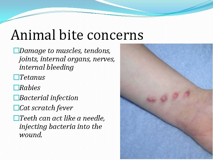 Animal bite concerns �Damage to muscles, tendons, joints, internal organs, nerves, internal bleeding �Tetanus