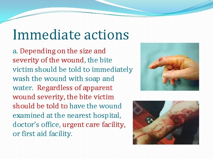 Immediate actions a. Depending on the size and severity of the wound, the bite