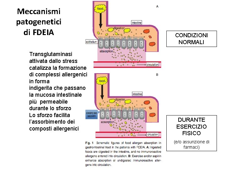 Meccanismi patogenetici di FDEIA Transglutaminasi attivata dallo stress catalizza la formazione di complessi allergenici