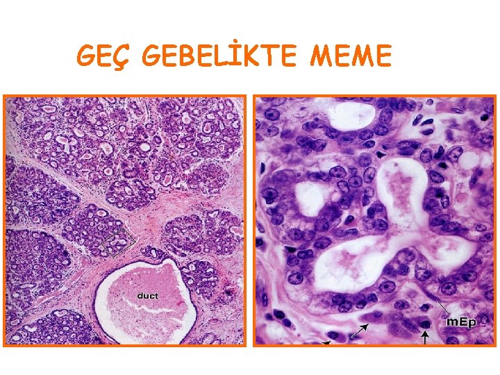 GEÇ GEBELİKTE MEME 