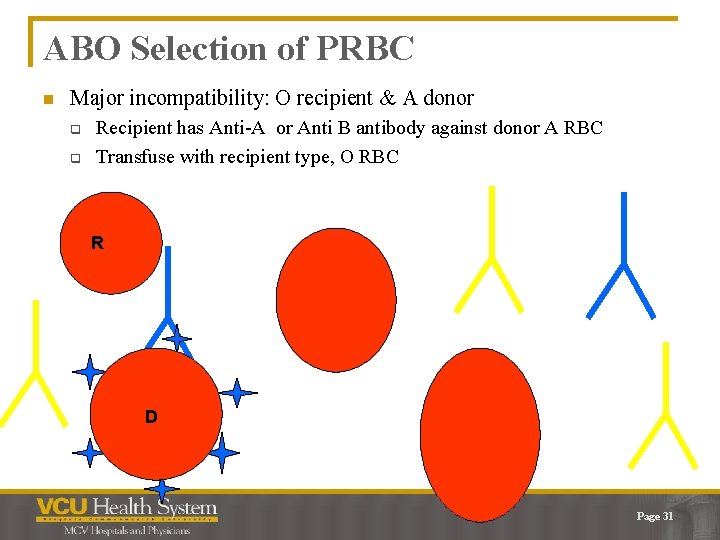ABO Selection of PRBC n Major incompatibility: O recipient & A donor q q