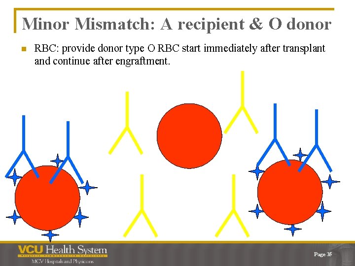 Minor Mismatch: A recipient & O donor n RBC: provide donor type O RBC