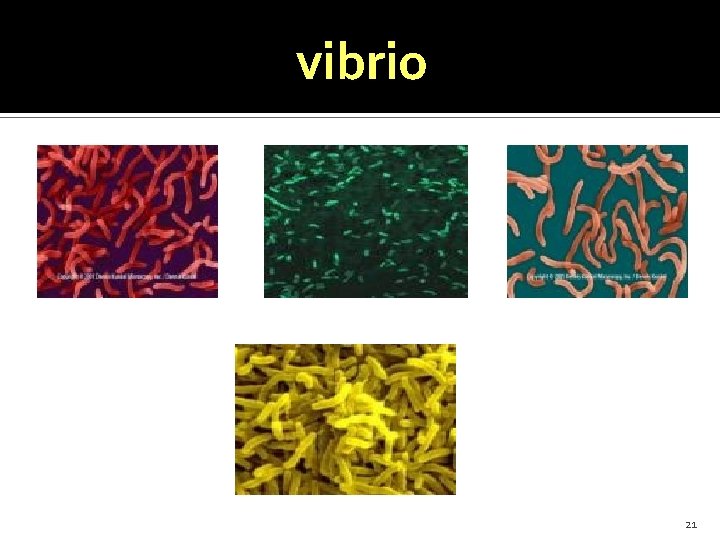 vibrio 21 