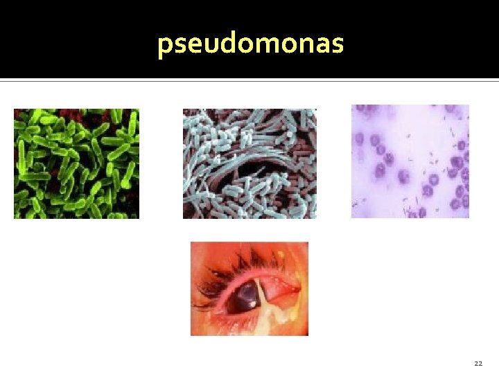 pseudomonas 22 