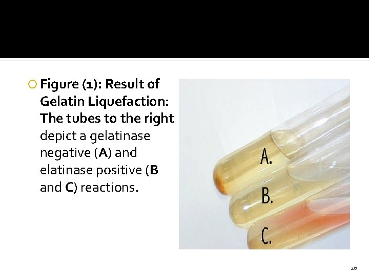  Figure (1): Result of Gelatin Liquefaction: The tubes to the right depict a