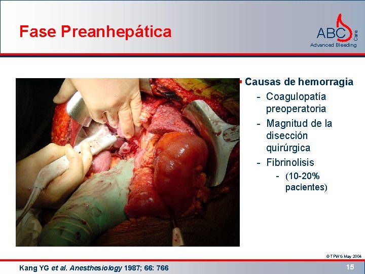 ABC Care Fase Preanhepática Advanced Bleeding § Causas de hemorragia - Coagulopatía preoperatoria -