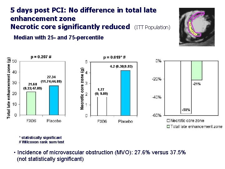 5 days post PCI: No difference in total late enhancement zone Necrotic core significantly