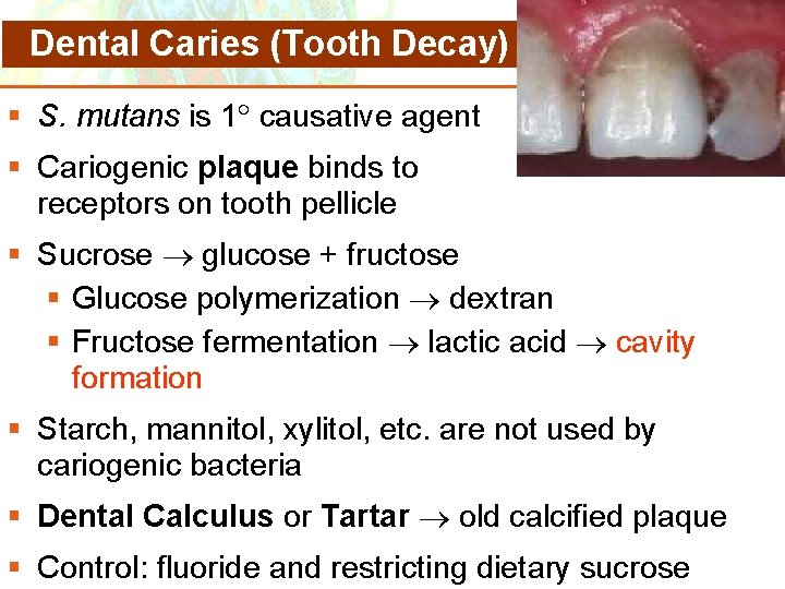 Ch 25 Microbial Diseases of the Digestive System