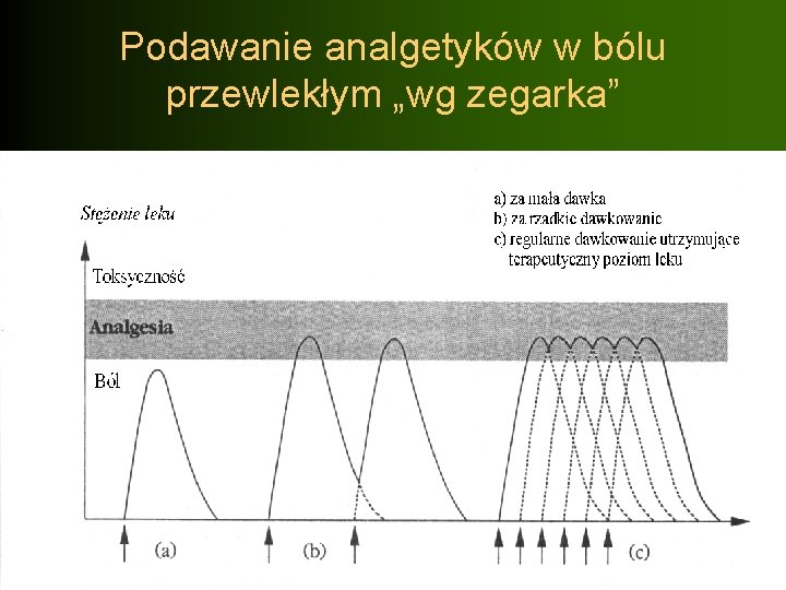 Podawanie analgetyków w bólu przewlekłym „wg zegarka” 