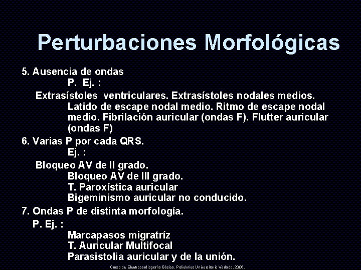 Perturbaciones Morfológicas 5. Ausencia de ondas P. Ej. : Extrasístoles ventriculares. Extrasístoles nodales medios.