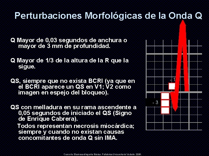 Perturbaciones Morfológicas de la Onda Q Q Mayor de 0, 03 segundos de anchura