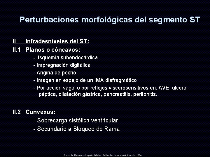 Perturbaciones morfológicas del segmento ST II Infradesniveles del ST: II. 1 Planos o cóncavos: