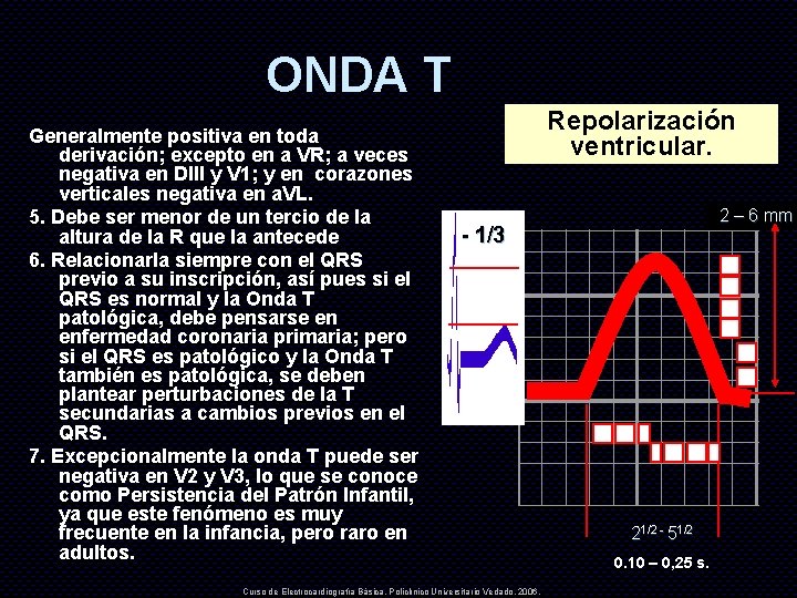 ONDA T Generalmente positiva en toda derivación; excepto en a VR; a veces negativa