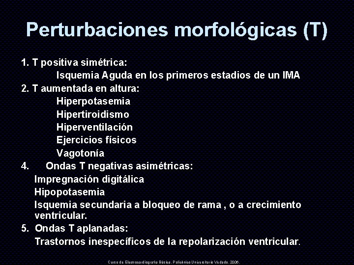 Perturbaciones morfológicas (T) 1. T positiva simétrica: Isquemia Aguda en los primeros estadios de