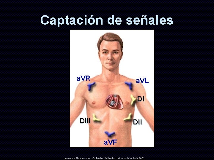 Captación de señales a. VR a. VL DI DII a. VF Curso de Electrocardiografía