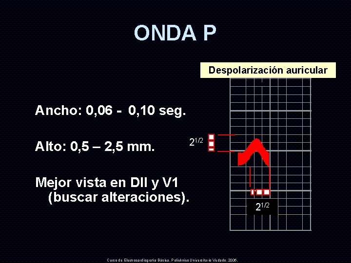 ONDA P Despolarización auricular Ancho: 0, 06 - 0, 10 seg. Alto: 0, 5